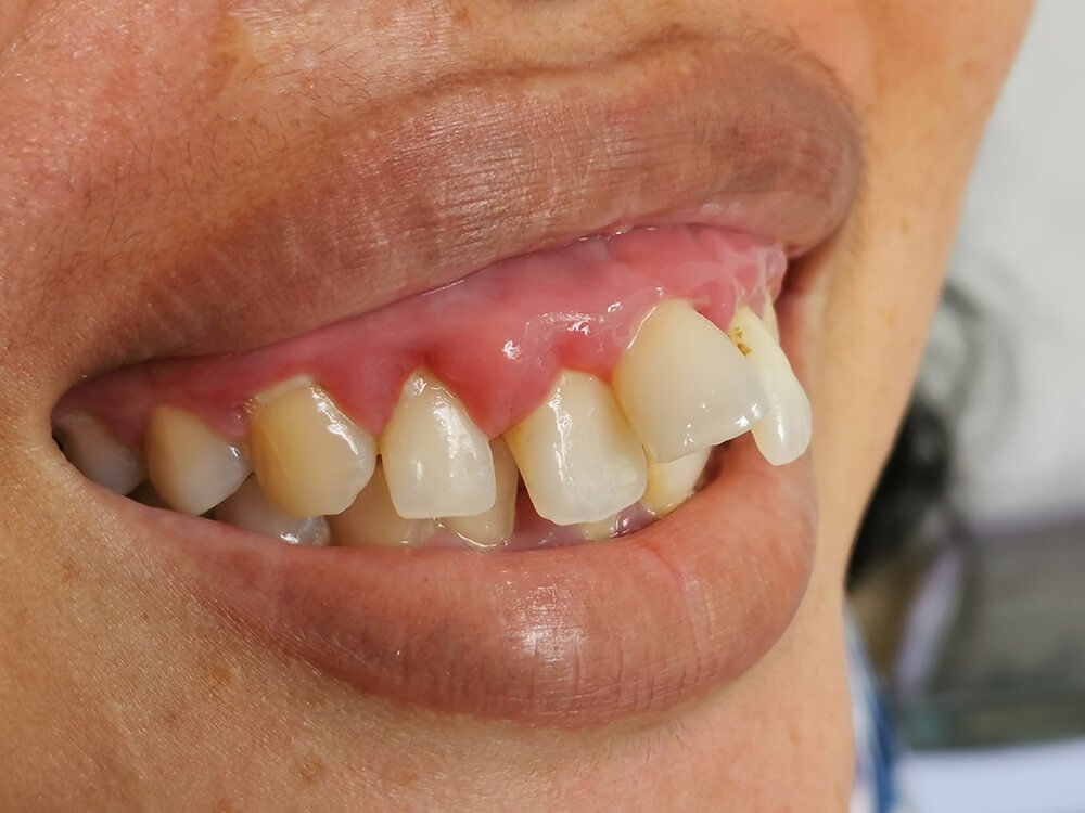 kn orthodontics p02 04