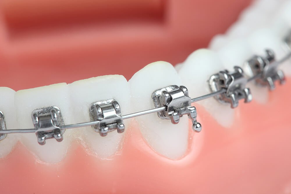 kn orthodontics p02 07