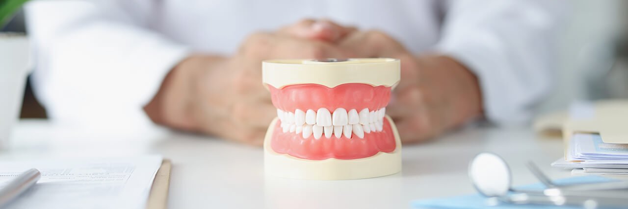 Q5. 我應該選哪種假牙比較好呢？