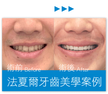 banner 260521 case