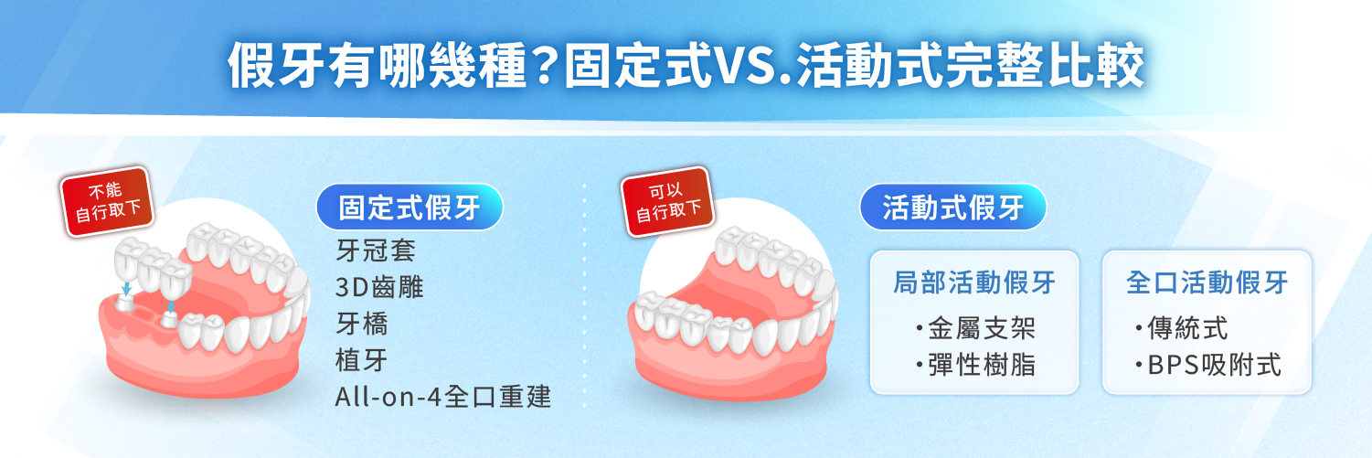 假牙有哪幾種？固定式 VS. 活動式完整比較