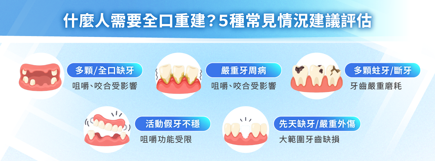 什麼人需要全口重建？5 種常見情況建議評估