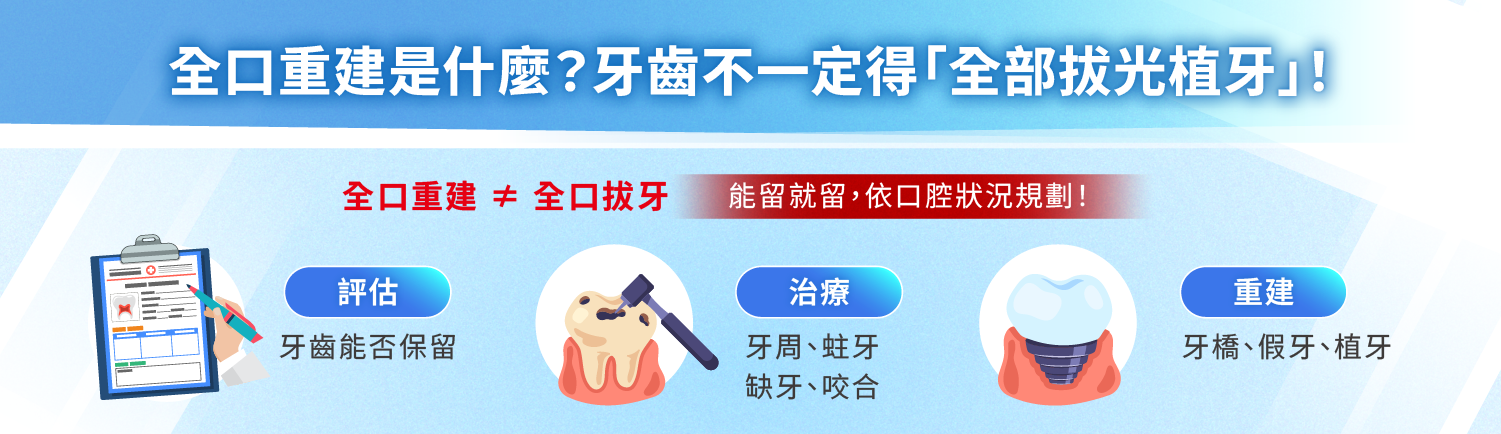 全口重建是什麼？牙齒不一定得「全部拔光植牙」！